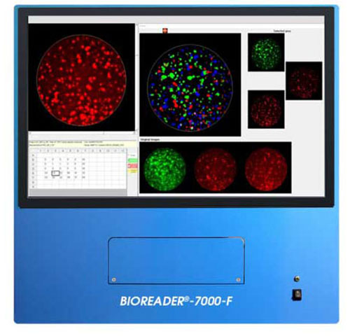 BIOREADER-7000-F.jpg
